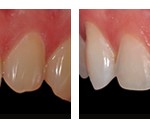 antes-despues201310-1