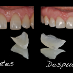 antes-despues8